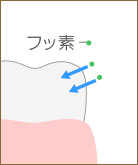 フッ素塗布の流れ